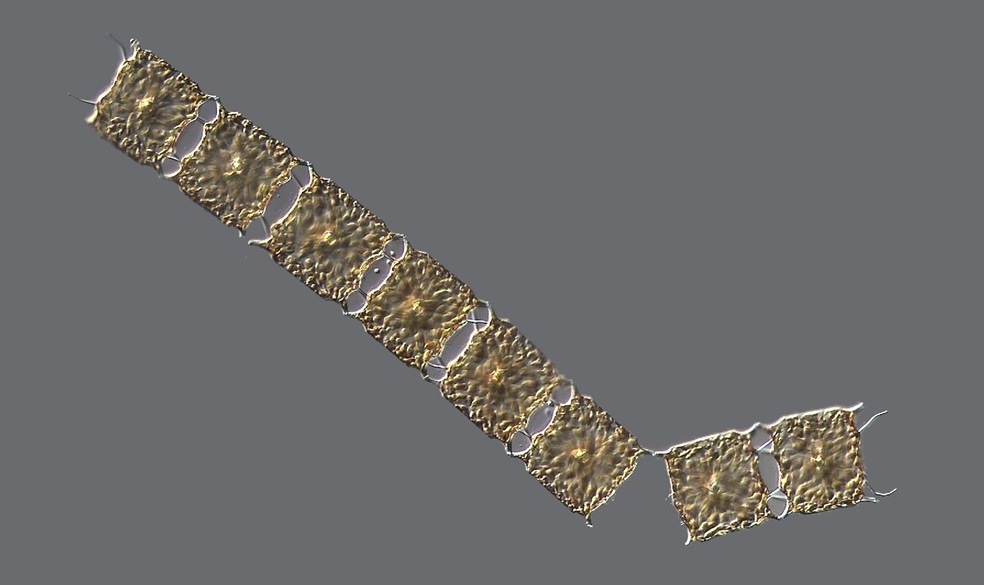 Odontella sp.
