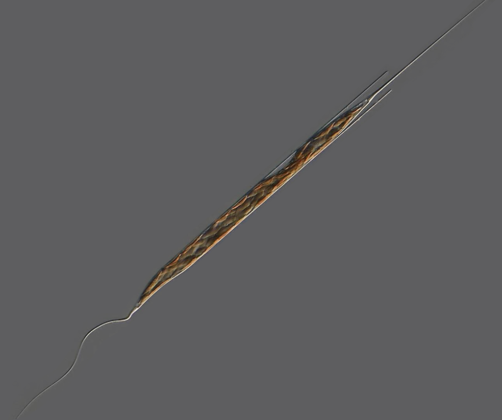 Rhizosolenia