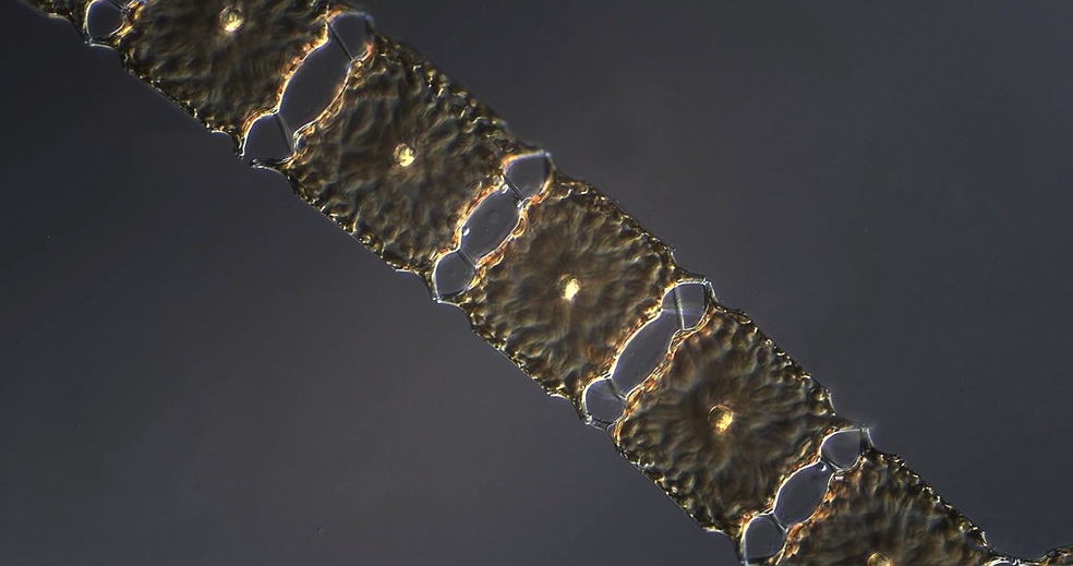 Odontella sp.