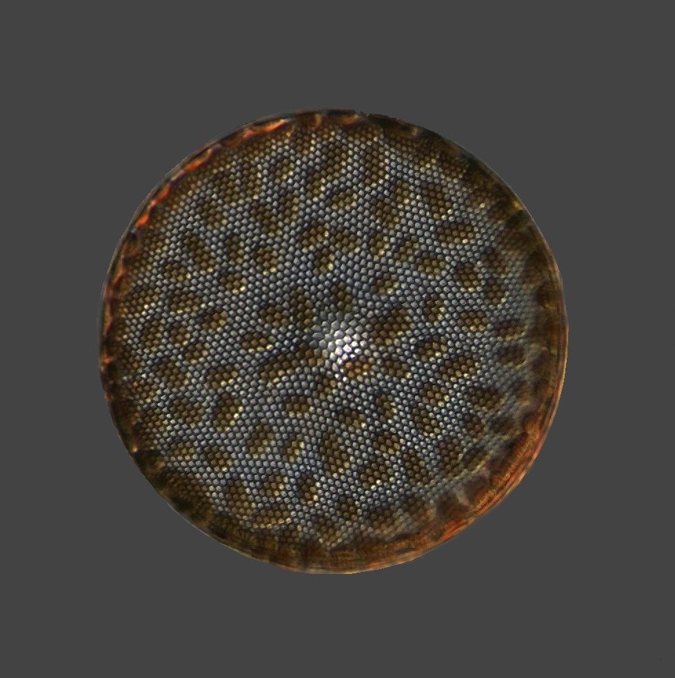 Centric diatom (Coscinodiscus?)
